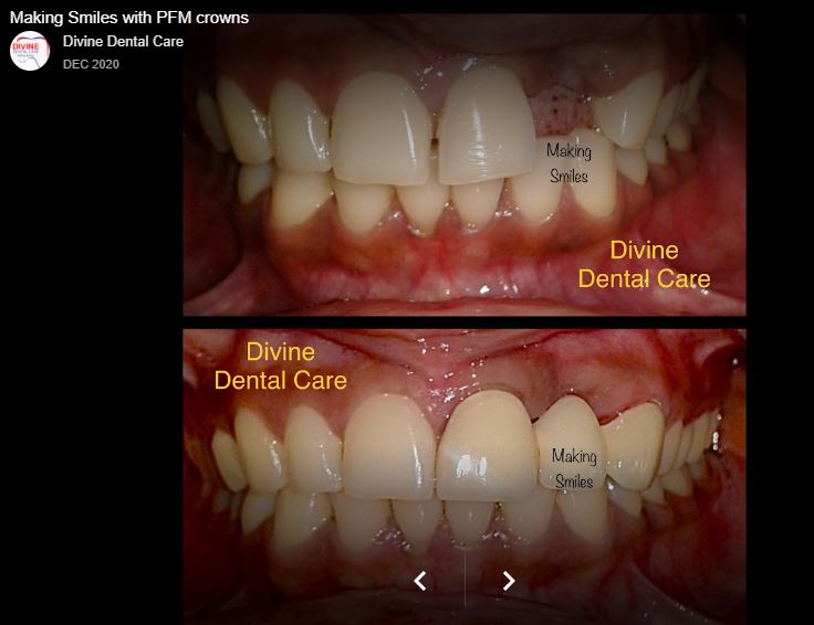 Dental Image